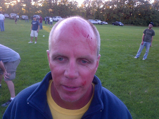 injured Wiffleball player